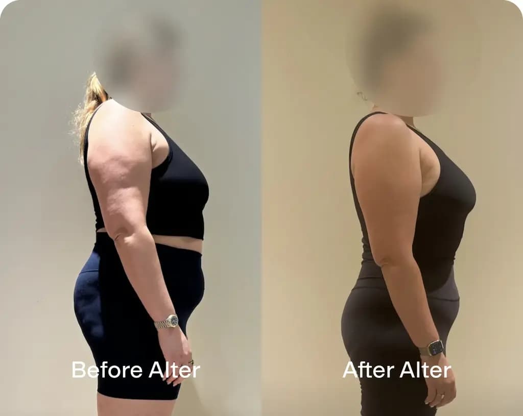 Before and After