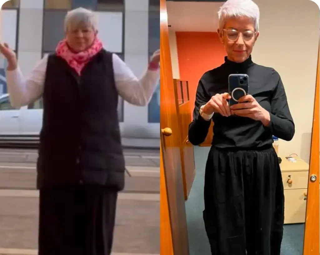 Before and After